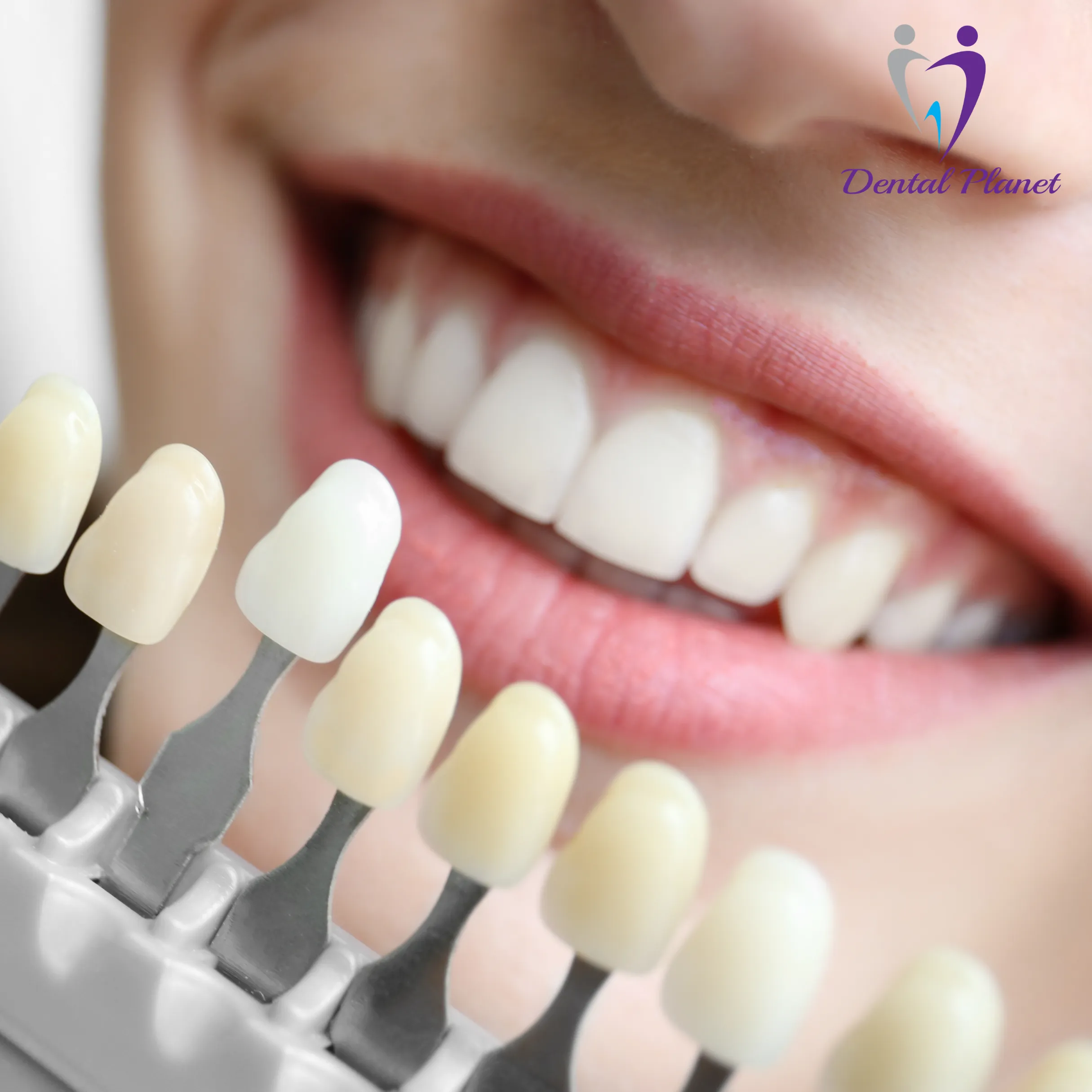 Best Dentist in Mysore
